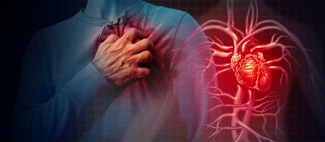 Heart Attack: Causes and Symptoms