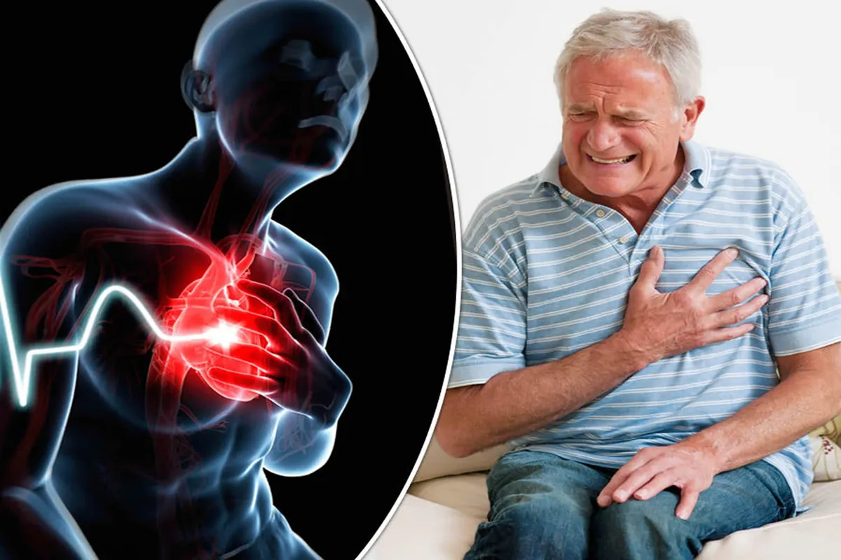 What is Mild Heart Attack: How Serous It Is?