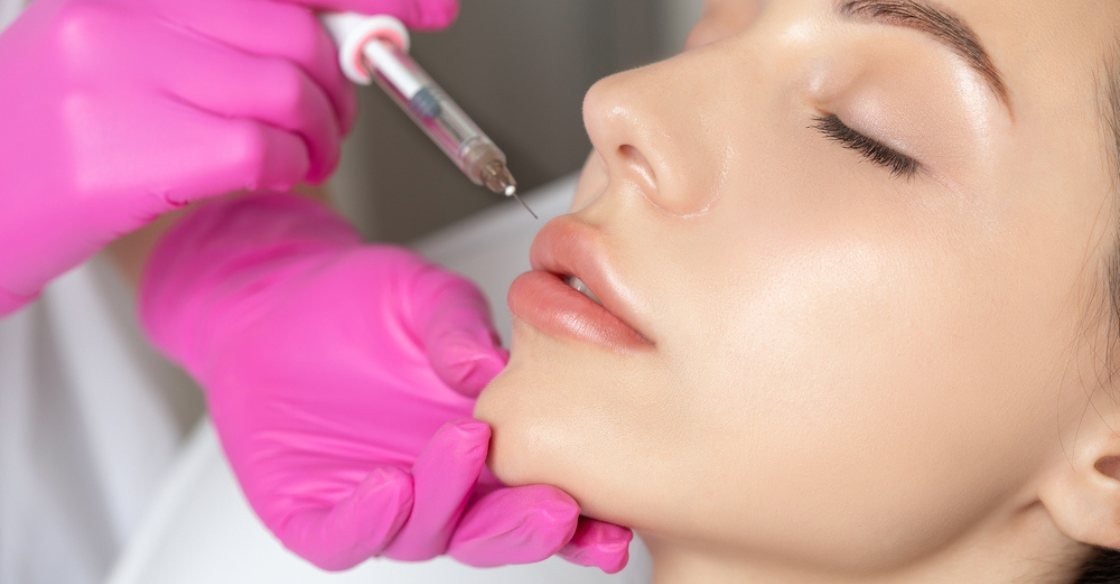 What Is Lip Filler Treatment?
