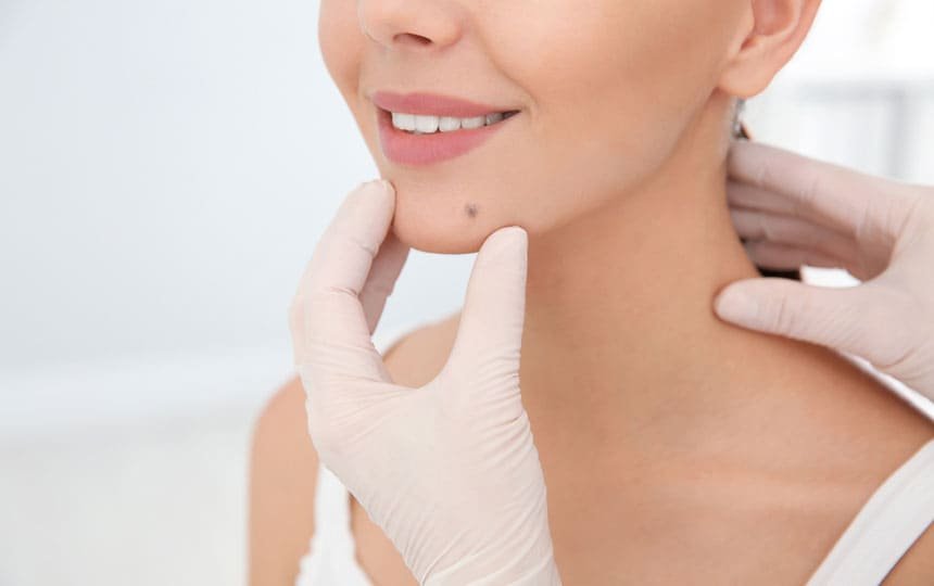 Auspicious Moles on Your Body That Signal Luck and Success