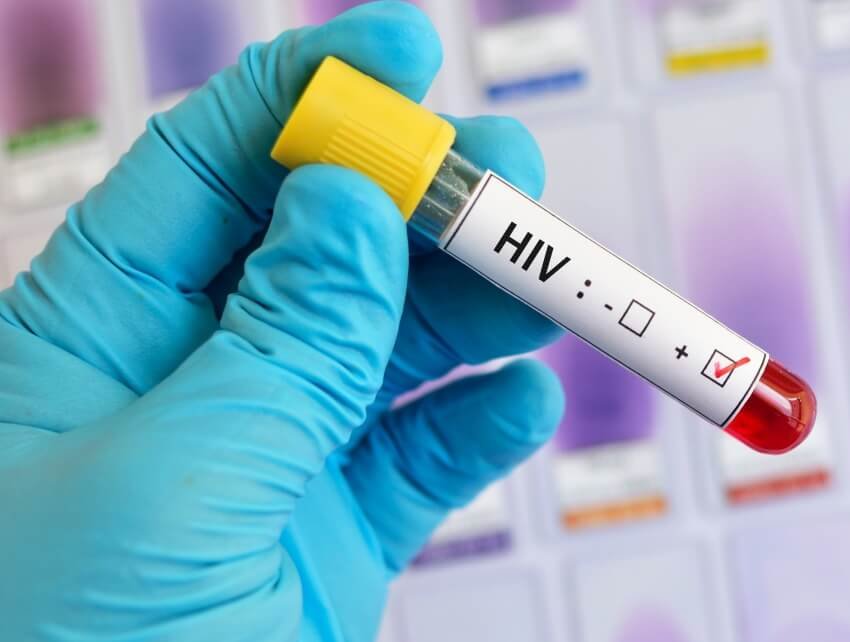 5 inmates test HIV positive in Chowdwar Jail